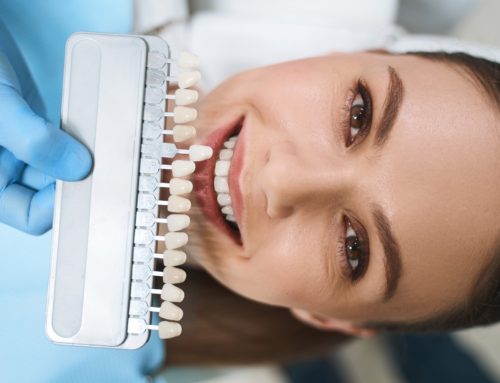 How To Improve Your Smile With Porcelain Veneers