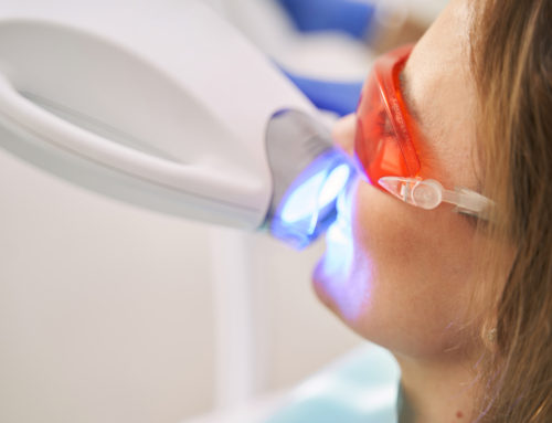 Laser Dentistry: Everything You Need to Know