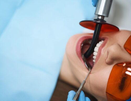 What Is A Root Canal, Really?