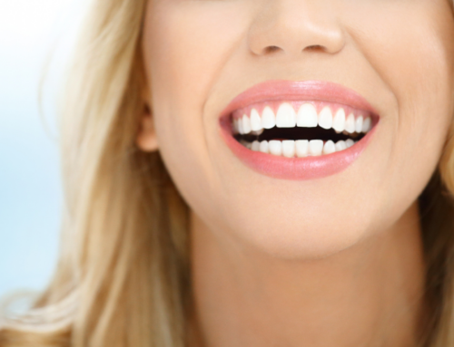 Get Porcelain Veneers To Achieve The Perfect Smile