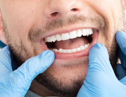 Oral Health and Stress: The Surprising Connection