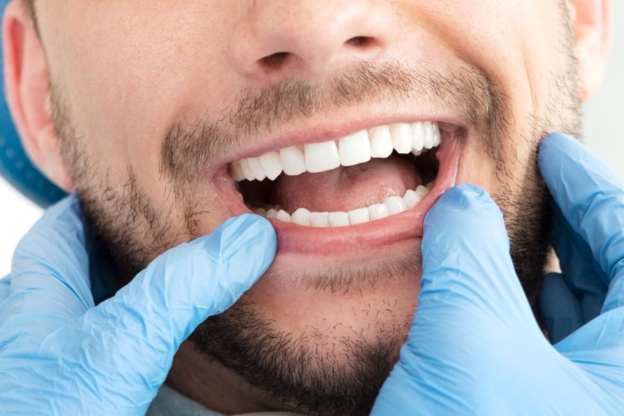 Oral Health and Stress: The Surprising Connection blog image