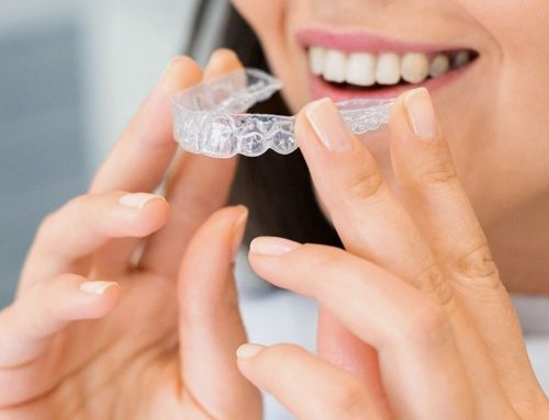 Is Summer the Right Time to Start Clear Aligners? What Reno Patients Should Know